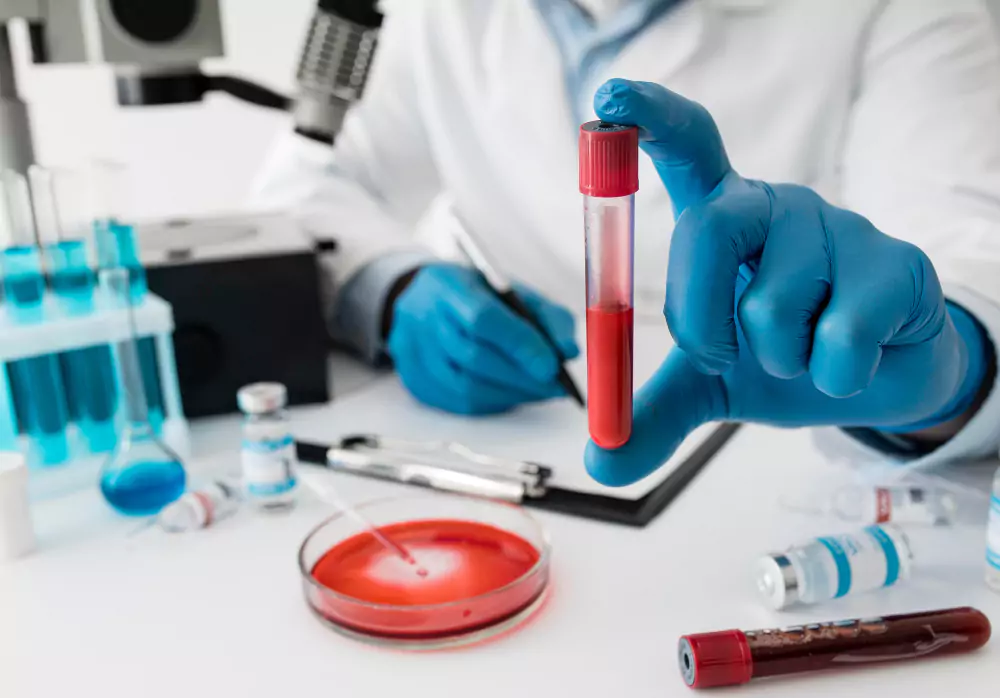 Serology